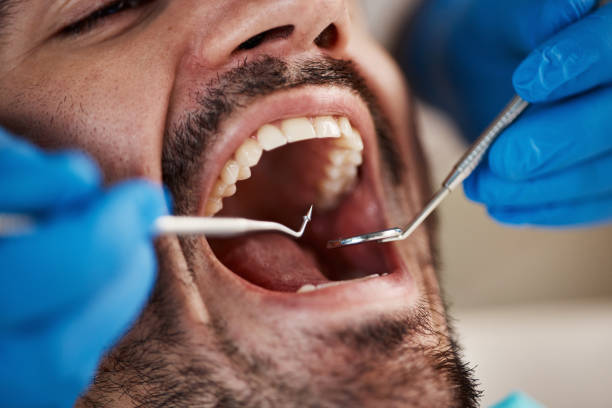 Best Emergency Gum Treatment in Los Altos, CA