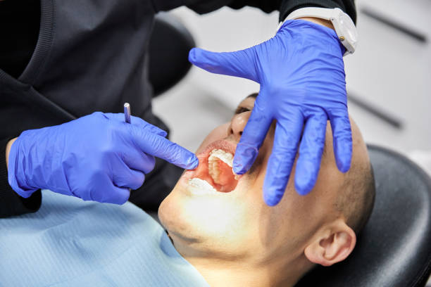 Best Emergency Dental Care for Broken or Chipped Teeth in Los Altos, CA