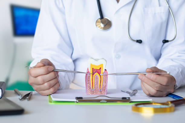 Best Urgent Care for Lost Fillings or Crowns in Los Altos, CA